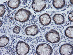 CMPK1 Antibody in Immunohistochemistry (Paraffin) (IHC (P))
