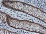 CMPK1 Antibody in Immunohistochemistry (Paraffin) (IHC (P))