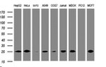 CMPK1 Antibody in Western Blot (WB)