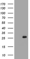 CMPK1 Antibody in Western Blot (WB)