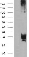 CMPK1 Antibody in Western Blot (WB)