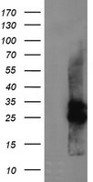 CMPK1 Antibody in Western Blot (WB)