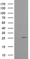 CMPK1 Antibody in Western Blot (WB)