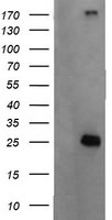 CMPK1 Antibody in Western Blot (WB)