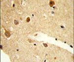 CNDP1 Antibody in Immunohistochemistry (IHC)