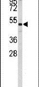 CNDP1 Antibody in Western Blot (WB)