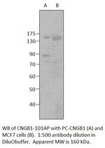 GARP Polyclonal Antibody