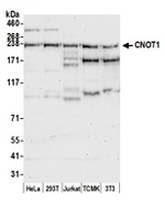 CNOT1 Polyclonal Antibody