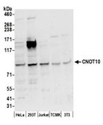 CNOT10 Antibody in Western Blot (WB)