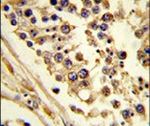CNOT4 Antibody in Immunohistochemistry (IHC)