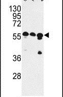 CNOT4 Antibody in Western Blot (WB)
