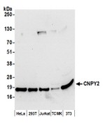 CNPY2 Polyclonal Antibody