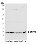 CNPY2 Polyclonal Antibody