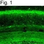 Cannabinoid Receptor 1 Antibody in Immunohistochemistry (IHC)