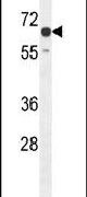 C15orf27 Antibody in Western Blot (WB)