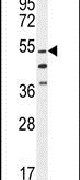 VWA9 Antibody in Western Blot (WB)