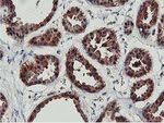 COASY Antibody in Immunohistochemistry (Paraffin) (IHC (P))