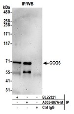 COG6 Antibody in Western Blot (WB)