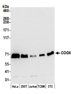 COG6 Polyclonal Antibody