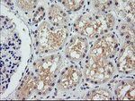 COG6 Antibody in Immunohistochemistry (Paraffin) (IHC (P))