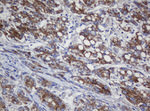 COG6 Antibody in Immunohistochemistry (Paraffin) (IHC (P))