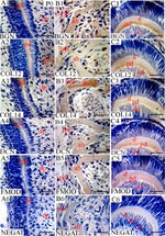 COL14A1 Antibody in Immunohistochemistry (IHC)