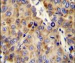 Endostatin Antibody in Immunohistochemistry (IHC)