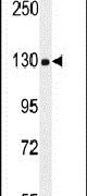 Endostatin Antibody in Western Blot (WB)