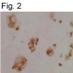 CLAC-P Polyclonal Antibody