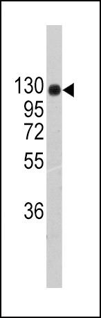 Collagen II Antibody in Western Blot (WB)