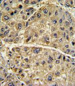 COL6A1 Antibody in Immunohistochemistry (IHC)