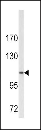 COL6A1 Antibody in Western Blot (WB)