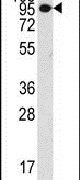 COL9A1 Antibody in Western Blot (WB)