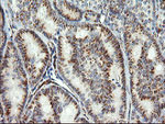 COPS6 Antibody in Immunohistochemistry (Paraffin) (IHC (P))
