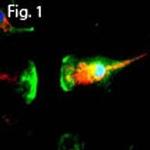 Coronin 1A Antibody in Immunocytochemistry (ICC/IF)