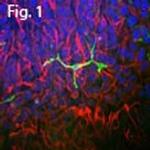 Coronin 1A Antibody in Immunocytochemistry (ICC/IF)