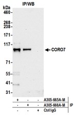 CORO7 Antibody in Western Blot (WB)