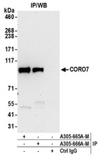 CORO7 Antibody in Western Blot (WB)