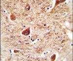 Coronin 7 Antibody in Immunohistochemistry (IHC)