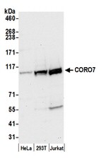 CORO7 Polyclonal Antibody