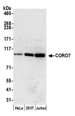 CORO7 Polyclonal Antibody