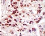 TPL2 Antibody in Immunohistochemistry (IHC)
