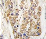 TPL2 Antibody in Immunohistochemistry (IHC)