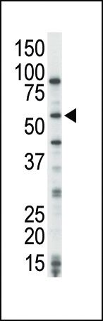 TPL2 Antibody in Western Blot (WB)