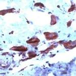 COX2 Polyclonal Antibody