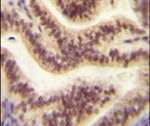 CP045 Antibody in Immunohistochemistry (IHC)