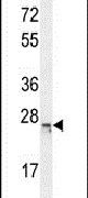 CP045 Antibody in Western Blot (WB)
