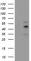 CPA1 (Carboxypeptidase A1) Antibody in Western Blot (WB)