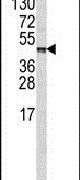Carboxypeptidase B2 Antibody in Western Blot (WB)