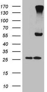 CPM Antibody in Western Blot (WB)